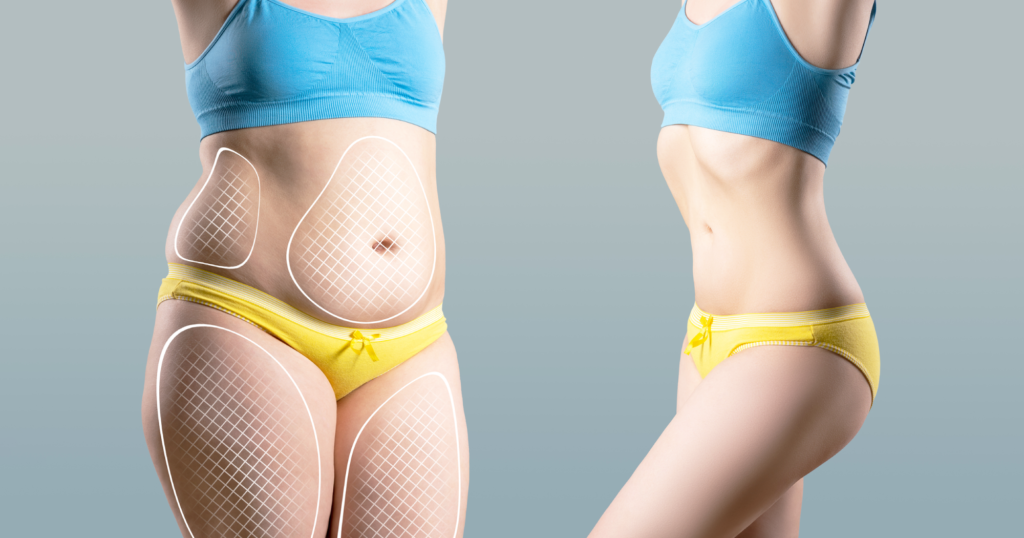 女性のふくよかな体型とスリムな体型の比較画像